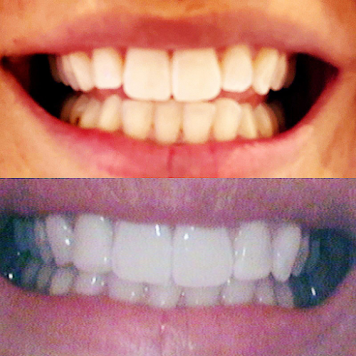 Starlite Dental Finberry