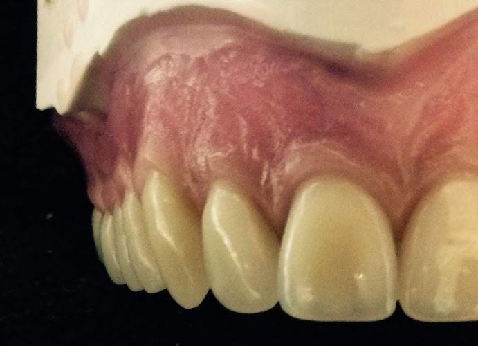 Swindon Dental Laboratory Ltd......Also Providing Denture Repairs to the Public