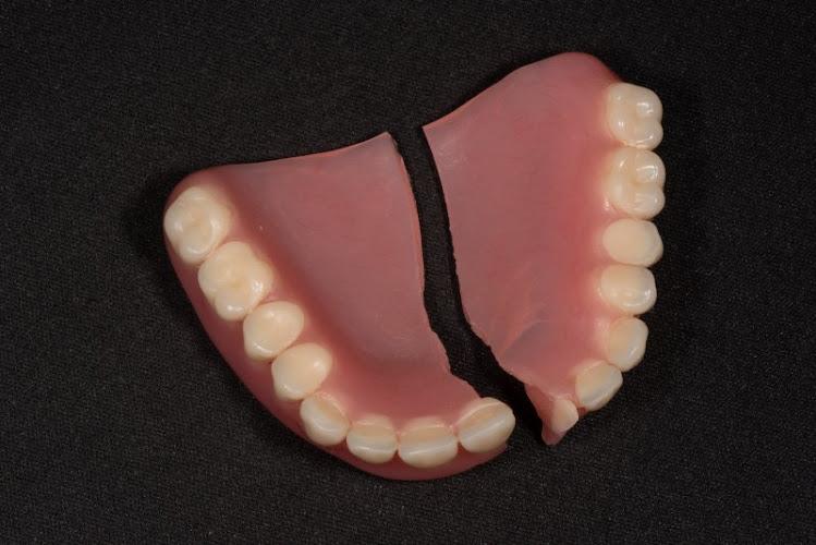 Surrey Denture Repairs