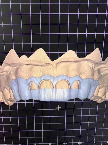 Primo Dental Laboratory