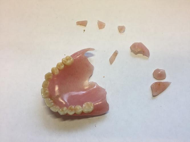 Bristol and Bath Denture Repairs