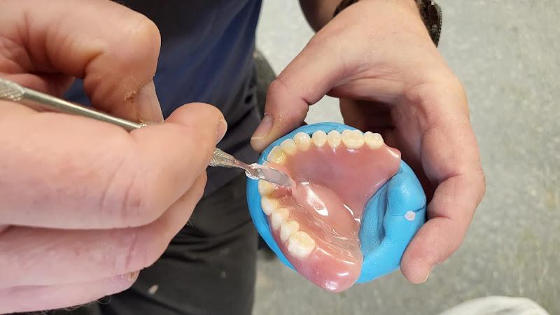Elite Chrome Dental - Denture Repairs