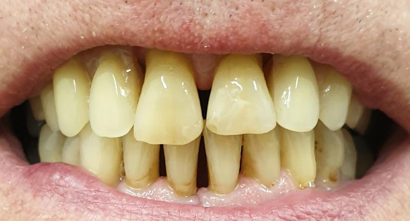 KMO Dental Laboratory - Denture Repairs- New Dentures made