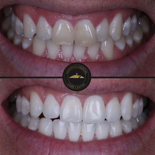 Horwich Dental Care Centre