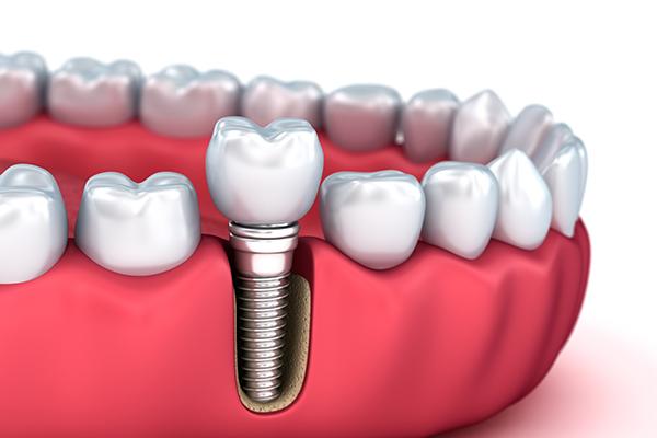 Stone Cottage Dental Surgery