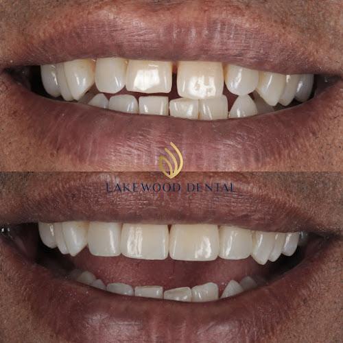 Lakewood Dental