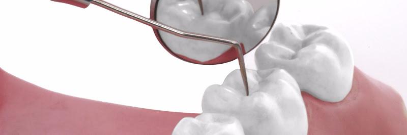 Emergency Dentist Leicester