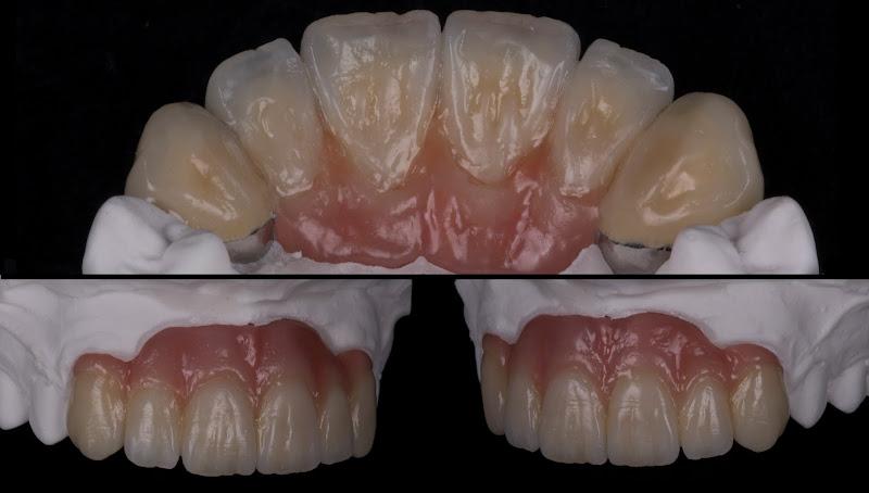 PCG Dental Design
