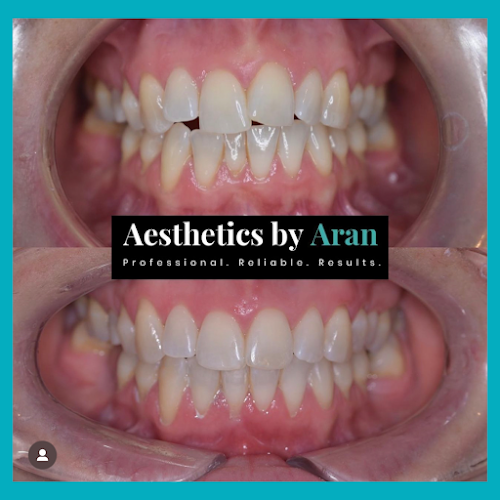 Aesthetics by Aran | Cosmetic Dentist Edinburgh