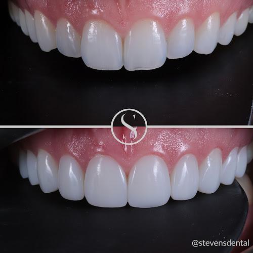 STEVENSDENTAL