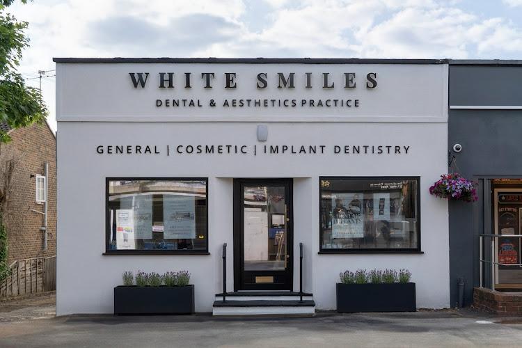 White Smiles Sunningdale