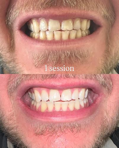 White Smile Ancoats - Laser teeth whitening Manchester