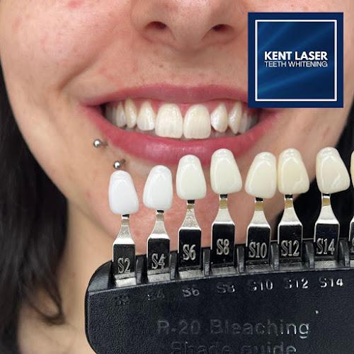Kent Laser Teeth Whitening