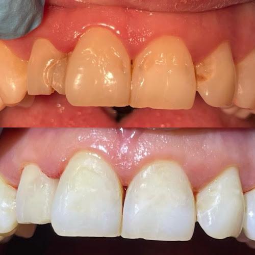 Alauna Dental Care Maryport