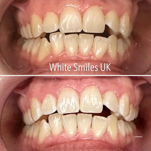 White Smiles UK