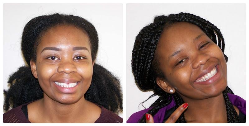 Straight White Teeth Ealing