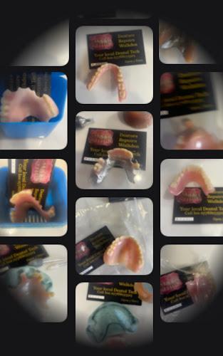 Denture repair 24/7 lab