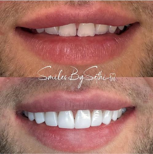 Berkeley Dental x SmilesBySethi