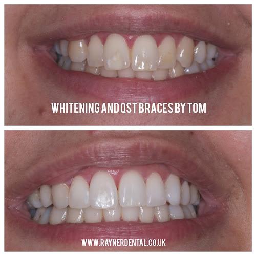 Rayner Dental Practice Wibsey