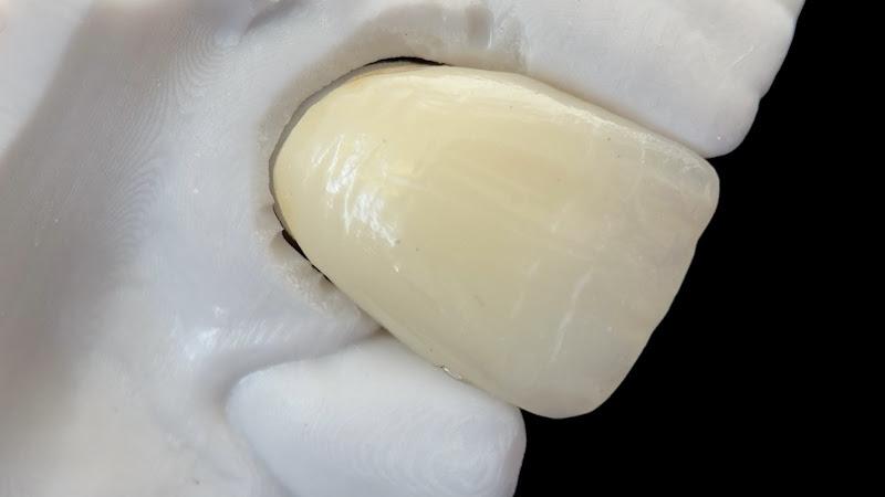 ToothWorx Dental Laboratory