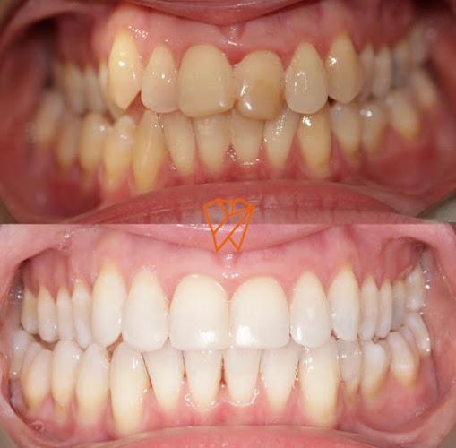 Clayhall Dental Care - Cosmetic & Implant Dentistry