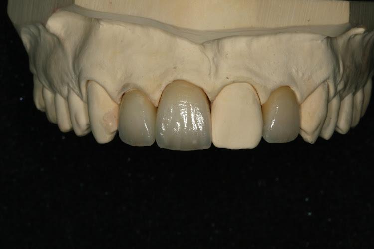 Central Dental Laboratory Ltd