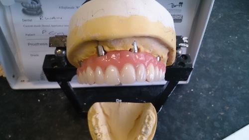 The Dental Studio Prosthetics