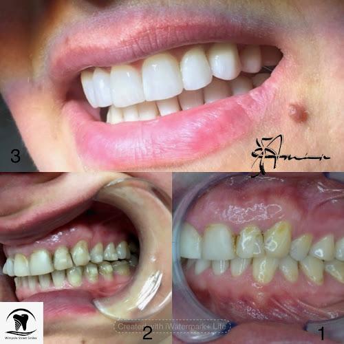 Wimpole Street Smiles - Dr Amir Ataei Kachooei