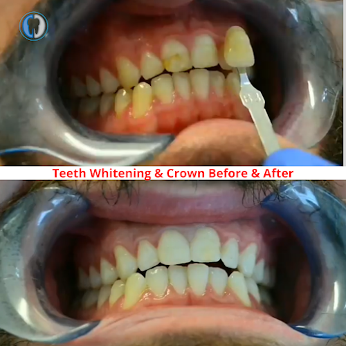 Dr Aiman Sinjab | Emergency Dentist Crewe