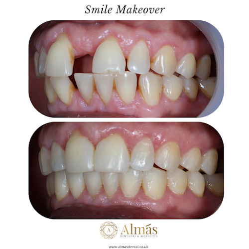 Almás Dentist & Aesthetics - Acton