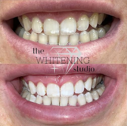 The Whitening Studio