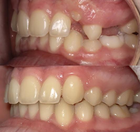 Dr Emmett Hegarty Specialist Orthodontist