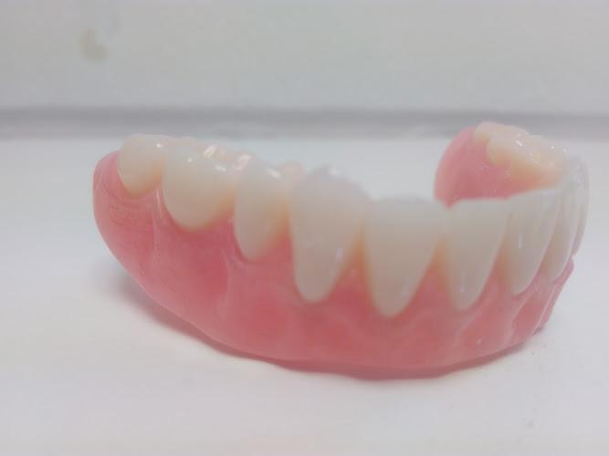 Naprawy Protez Londyn