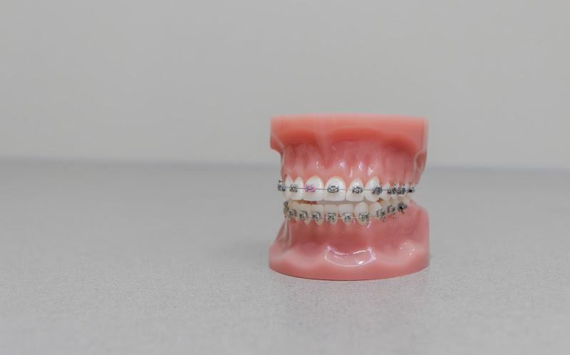 Peachcroft Orthodontics