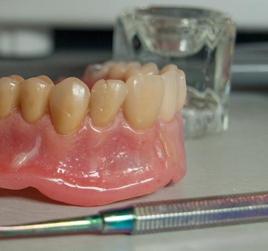Northumberland Denture Repairs Direct