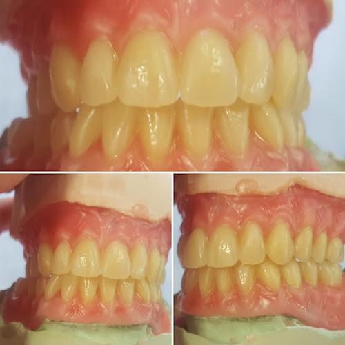 AKJ Dentures Ltd - dental laboratory (denture repair, naprawa protez)