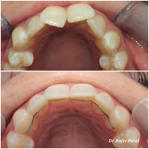 Inspire Dental Care: Implant & Invisalign Centre