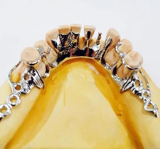 Chrome Cast Dental Laboratory