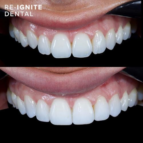 Re-Ignite Dental