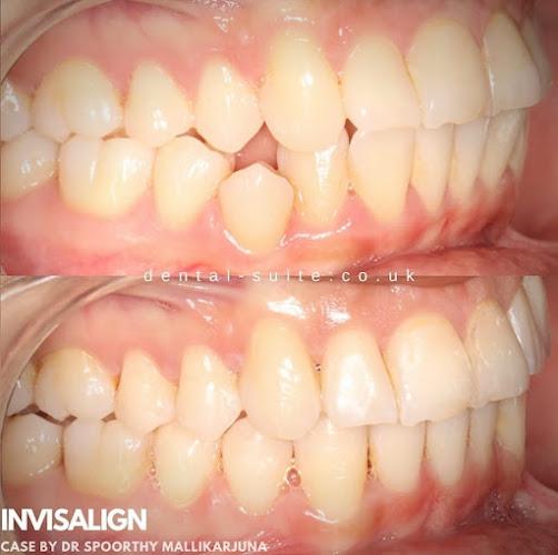 The Dental Suite - Leicester