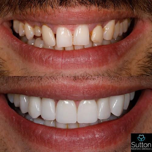 Sutton Aesthetic Dentistry