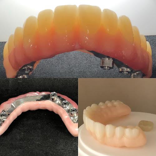 Ambridge Ceramics - Award Winning Cosmetic Digital Dental Implant Laboratory