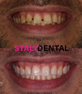 STALY Dental - Stalybridge