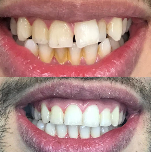 Dental Perfection Kettering